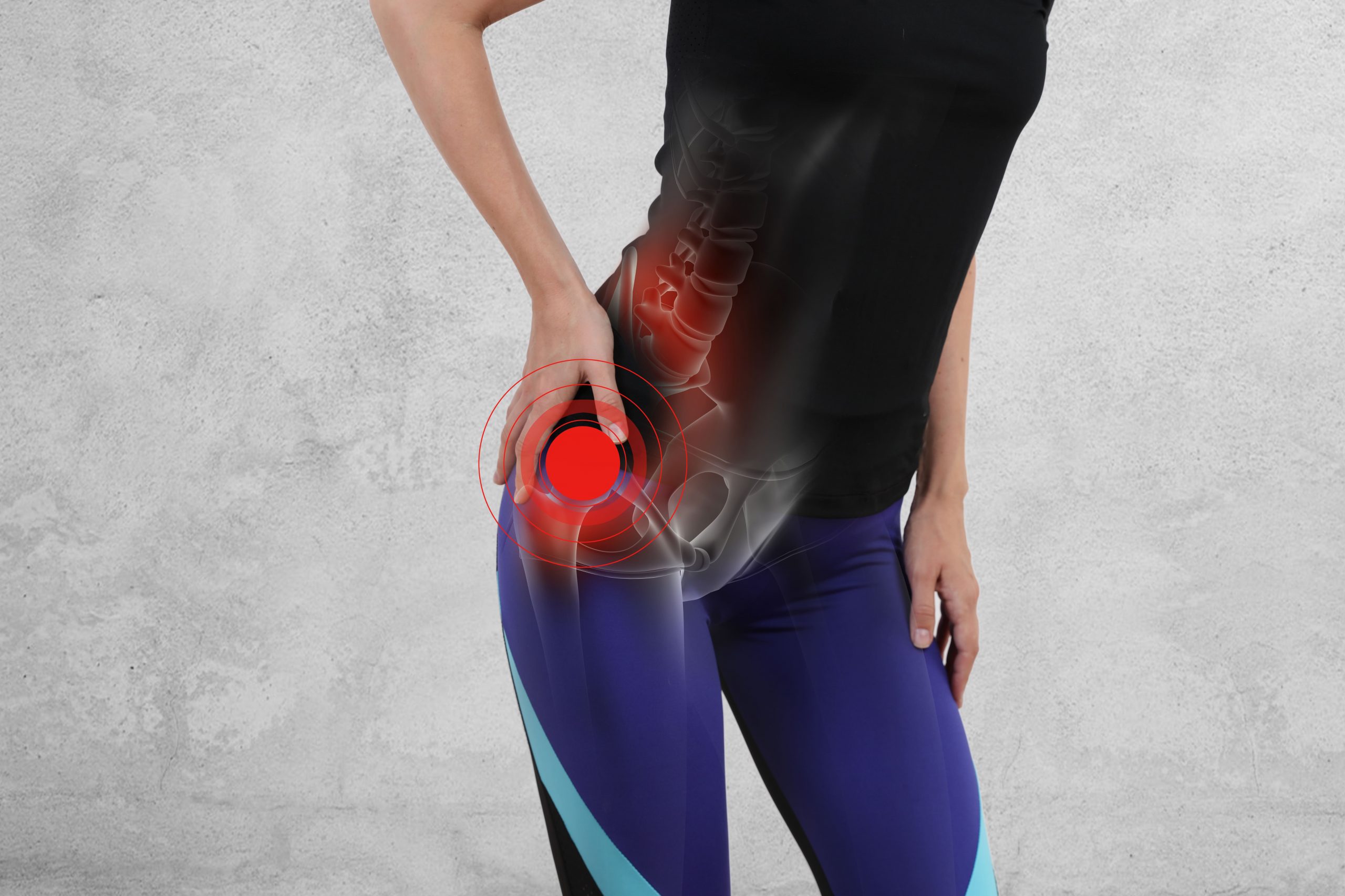 How to Get Rid of Hip Pain